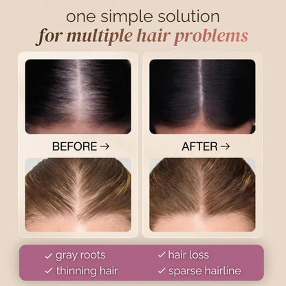 Nizole Dab & Go Hair Concealer